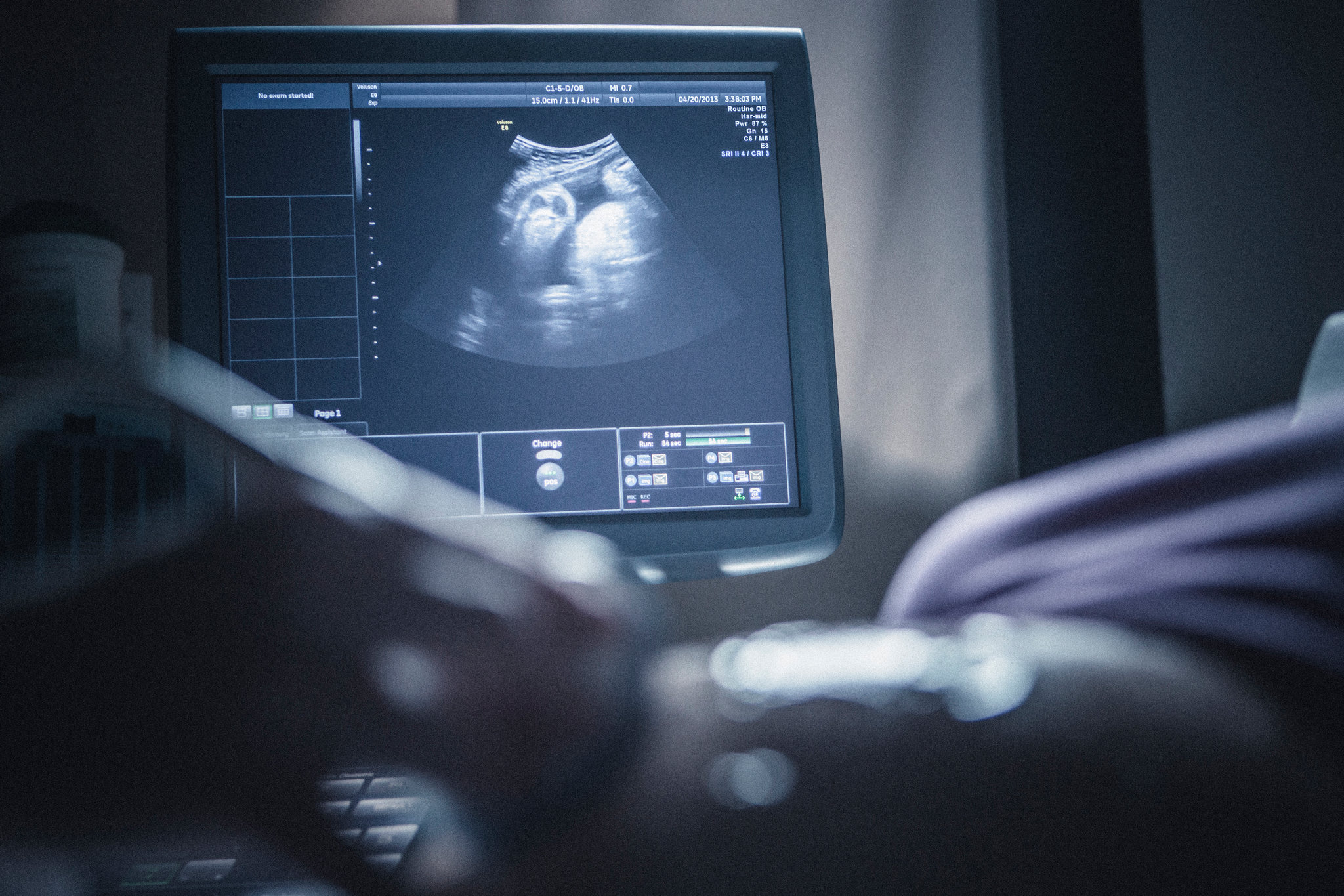 Exploring the Advantages of Private Ultrasound for Expecting Mothers